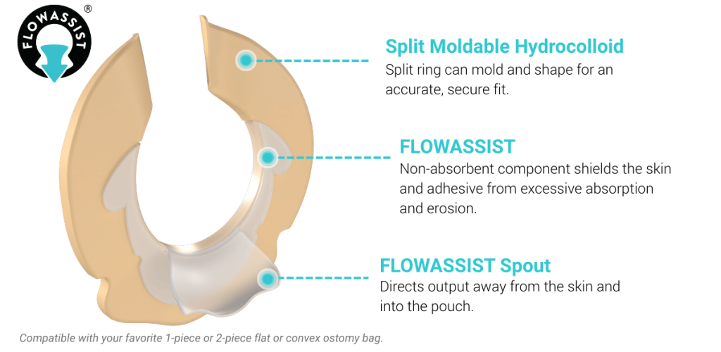 Ostoform FLOWASSIST Seal with flow-direction spout